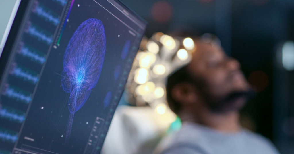 Transformacja mózgu.